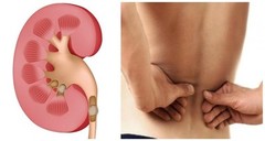 Kidney Herbs – KIDNEY SUPPORT – Kidney Repair 3 Bottles 180 Capsules