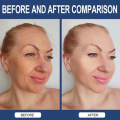 3 Pack Hyaluronic Acid Capsules – for Joint Health and Skin Hydration Anti-Aging