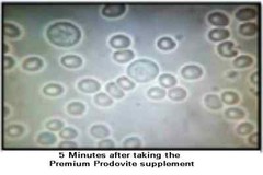 Prodovite Athletic Nutrition(1pk) – Changes the Blood Cells In 5 Minutes see VID