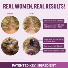 Factor FOKGE Hair Growth Accelerator Soft Chews, Hair Growth Vitamins For Women