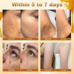 2Pcs Bee Venom Skin Treatment Cream, Comprehensive skincare Cream,…