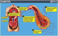 TRIGLYCERIDES HIGH & BAD CHOLESTEROL REMOVER & FLUSHER & SUGAR DOWN