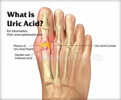 URIC ACID COMPLEX – diuretic herbs for water retention – digestion fiber 2 B