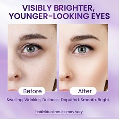 Doracome Caffeine & Retinol Under Eye 0.7 Fl Oz (Pack of 1), Vintage Violet