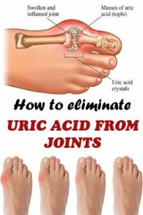 URIC ACID COMPLEX – blood pressure support herbs – heart health herbs 3Bot