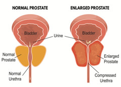 Full-Spectrum Herbal Cleansing – PROSTATE SUPPORT – Daily Nutrient 3Bot