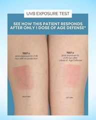 Inner Glow Age Defense Vitamins – Dermatologist and Plastic Surgeon Developed to