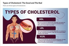 TRIGLYCERIDES HIGH & BAD CHOLESTEROL REMOVER & FLUSHER & SUGAR DOWN