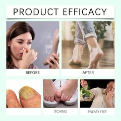 100ml Foot Sanitizer Spray with Tea Tree Oil, Tea Tree Oil Foot Spray 2025 New