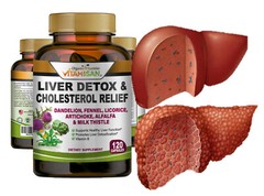 Liver Cleanse Detox Milk Thistle Extracts Silymarin, Artichoke, Dandelion, Vit B