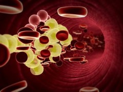 Blood pressure lowering – CHOLESTEROL RELIEF FORMULA – cholesterol balance – 1B