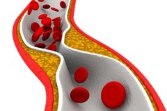 Blood pressure essentials-CHOLESTEROL RELIEF-1B-cholesterol lowering supplements