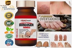 IMPROVED FORMULA HONGO SAN ORIGINAL ANTI FUNGAL ZANA NAIL ANTI FUGAL Support
