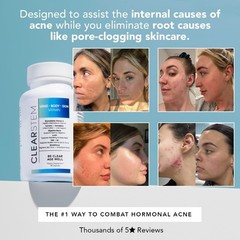 1-3Pc CLEARSTEM (age+acne) – MIND-BODY-SKIN Vitamin 90 Softgelsules.