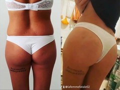 Rapid action BB 100% natural butt enlargement syrup wholesaler