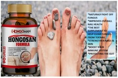 IMPROVED FORMULA HONGO SAN ORIGINAL ANTI FUNGAL ZANA NAIL ANTI FUGAL Support