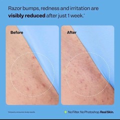 Peach Slices Smoothing Solution Ingrown Hair Treatment (1.69 oz) Smooth Relieve
