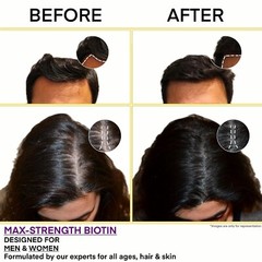 Vitamin B7 Biotin 10000mcg 120 Veg Tablets, Hair Growth, Skin & Nails Supplement