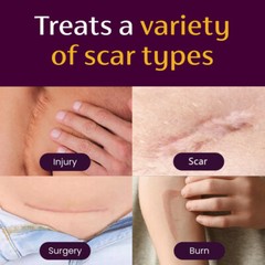 Scar Fading Capsules – 2000 Mg Proprietary Blend – Repair Improves Appearance