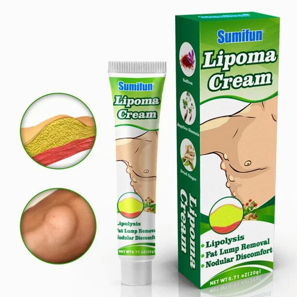 Sumifun 20g Lipomas Cream Antibacterial Cleansing Cellulite Fat Lump Removal