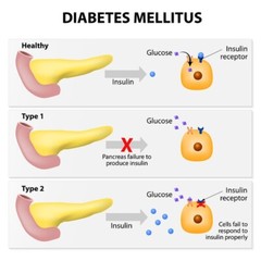 TRIGLYCERIDES HIGH & BAD CHOLESTEROL REMOVER & FLUSHER & SUGAR DOWN