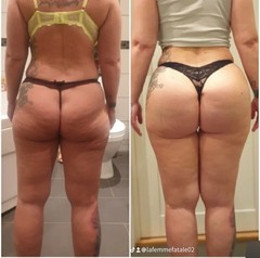 Rapid action BB 100% natural butt enlargement syrup wholesaler