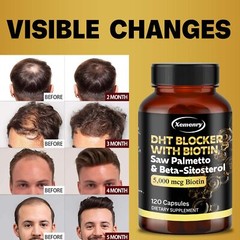 DHT Blocker Capsules – Saw Palmetto, Biotin,Beta-sitosterol – Boosts Hair Growth