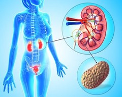 Blood Purification – KIDNEY SUPPORT – Herbal Support 1 Bottle 60 Capsules