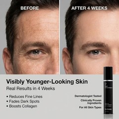 Anthony High Performance Vitamin A Treatment, Advanced Anti-Aging Face Cream …