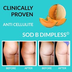 Cellulite Remover, Restless Leg Relief, Leg Circulation & Varicose Vein Support